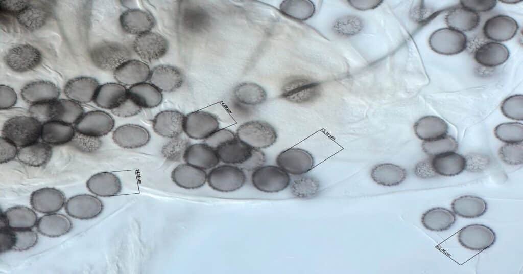 Mushroom-spores-seen-under-a-microscope