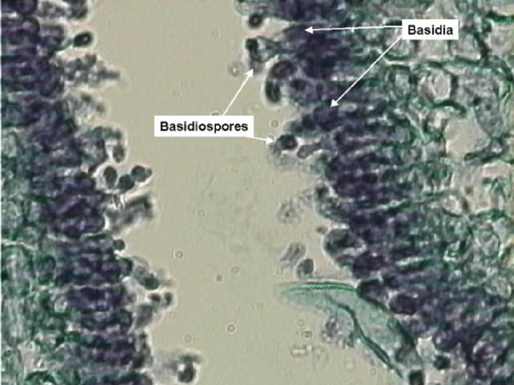 Basidia and Basidiospores magnified under a microscope