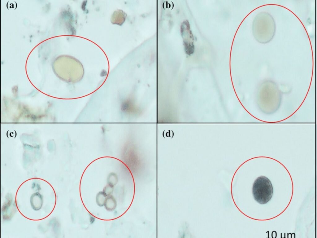 Mold Spores under a microscope