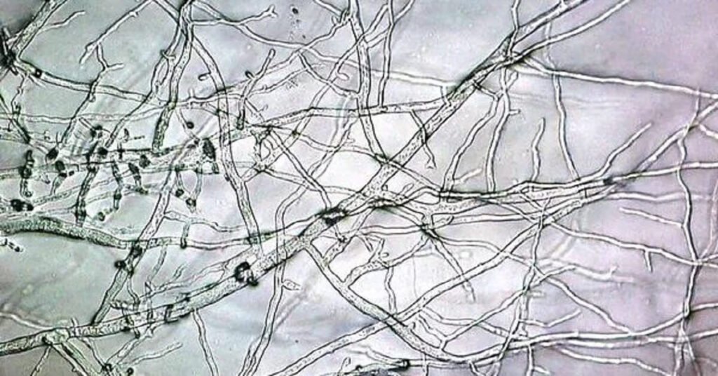 Mushroom mycelium magnified under a microscope
